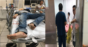 Truy bắt nhóm côn đồ chém trọng thương 2 người rồi bỏ trốn