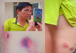 Xem xét kỷ luật chánh văn phòng huyện ủy đánh tài xế nhập viện ở Đắk Nông