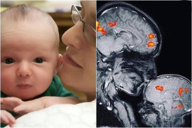 Điều kỳ diệu qua hình ảnh chụp cộng hưởng từ MRI của em bé khi ở bên mẹ
