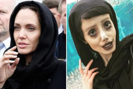 Phiên bản lỗi của Angelina Jolie và những trải lòng sau 50 cuộc phẫu thuật thẩm mỹ