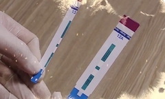 Cắt đôi que xét nghiệm HIV và viêm gan B ở Bệnh viện Xanh Pôn: Sở Y tế Hà Nội nói gì?