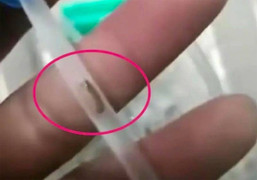 Bé 3 tuổi bị nhiễm trùng vì ống truyền dịch có 'giun', bệnh viện xin lỗi