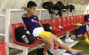 Đình Trọng chấn thương, HLV Park Hang Seo gọi quân U23 Việt Nam thay thế