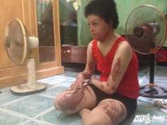 Người vợ trẻ bị chồng vũ phu tẩm xăng thiêu sống trước mặt con