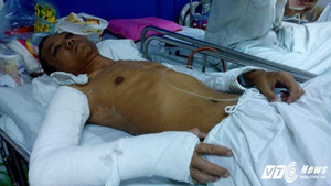 Ngồi trà đá vỉa hè, nam thanh niên bị côn đồ truy sát