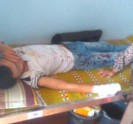 Nam thanh niên bị côn đồ kéo đến nhà chém nhập viện