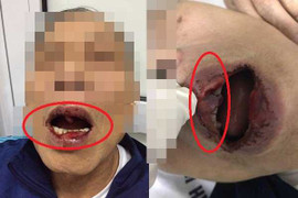 Cách chức cán bộ Sở Ngoại vụ hành hung tiến sĩ 76 tuổi