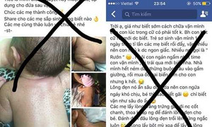 Tránh xa ngay 4 mẹo dân gian chữa bệnh có thể gây chết người