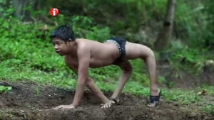 Có ít nhất 80.000 người trên Trái đất đang buộc phải bò vì căn bệnh này