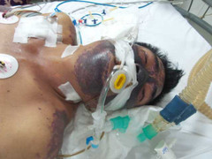 Căn bệnh chết người dễ mắc phải vì những hiểu lầm này