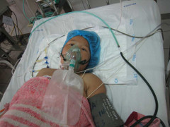 Lần đầu tiên cứu sống sản phụ và thai nhi ở người mẹ mang thai trong ổ bụng đã 38 tuần