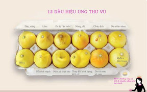 Xem quả chanh để biết các cấp độ ung thư vú