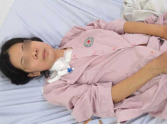 Cưa xương ức, cứu bệnh nhân bị viêm màng ngoài tim phức tạp