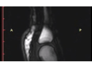 Giải mã thói quen bẻ ngón tay 'khục khục'