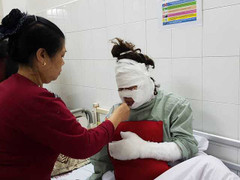 Nổ chùm 40 quả bóng bay trang trí sinh nhật, nhiều người bị bỏng