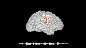 Công nghệ kỳ diệu giúp người câm nói bằng suy nghĩ