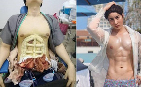 Video: Trào lưu 'tạc bụng 6 múi' đau đớn đang gây sốt tại Thái Lan