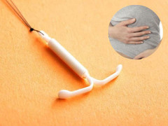 Vòng tránh thai 'đi lạc' đâm thủng bàng quang