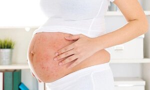 Người phụ nữ sinh 69 đứa con trong 76 năm