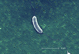 Biến đổi khí hậu làm gia tăng vi khuẩn ăn thịt người