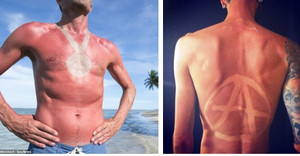 Nguy cơ ung thư từ trào lưu hình xăm rám nắng đang gây sốt