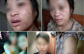 Video: Chỉ vì mua đôi giày, thai phụ bị chồng đánh động thai