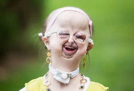 Video: Kỳ lạ cô gái 22 tuổi có ngoại hình như đứa trẻ