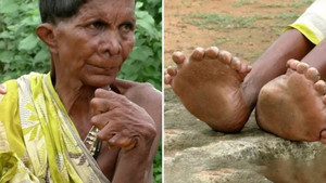 Video: Người phụ nữ 63 năm sống với 19 ngón chân, 12 ngón tay