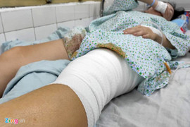 Nữ cổ động viên kể khoảnh khắc bị thương do pháo sáng ở Hàng Đẫy