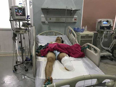 Xe máy va chạm xe tải, 3 người rơi xuống cầu: Nạn nhân sống sót duy nhất giờ ra sao?