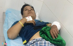 Tài xế bị chém đứt gân tay vì chuyện cẩu xe tại BOT Cai Lậy