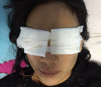 Phát hiện thi thể mẹ chồng tạt axit con dâu bỏng 2 mắt tại nhà riêng