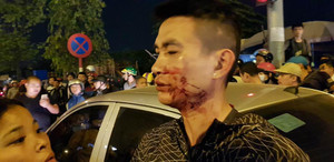 Sau va chạm giao thông, tài xế ô tô lao vào đánh đôi vợ chồng trẻ