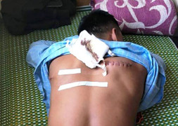 Đi ăn đêm, nam thanh niên bị đánh chém rồi cướp tài sản