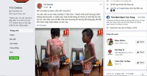 Xác minh thông tin cháu bé bị bố dượng hành hung dã man tại Thanh Hóa