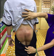 Bé trai 10 tuổi nghi bị bố đẻ và mẹ kế bạo hành, bắt uống nước sôi, ăn phân mèo