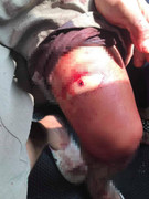 Đang ăn cơm trưa, 3 người trong gia đình bị nhóm côn đồ lao vào truy sát