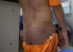 Công an vào cuộc vụ 4 anh chị em ở Cà Mau nghi bị ông nội bạo hành