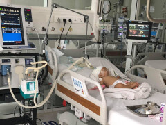 Bé gái 14 tháng tuổi bị khỉ nuôi tấn công đã xuất viện