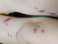 Sinh viên ký túc xá Đại học Quốc gia TP.HCM hoảng loạn do kiến ba khoang tấn công