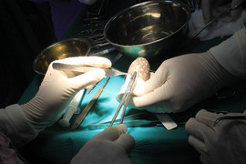 Sinh ra không có âm đạo, một phụ nữ phải chịu đau khổ suốt 23 năm trời