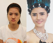 Cô gái trẻ 'đập mặt làm lại' mong thành DJ xinh đẹp