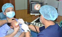 Viên bi nhựa nằm sâu trong hốc mũi của bé trai 4 tuổi
