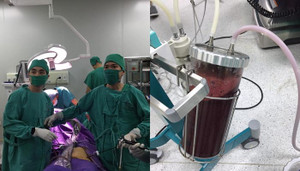 Cứu sống sản phụ chửa ngoài tử cung, máu ngập ổ bụng nguy kịch