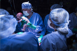 Thử nghiệm cấy ghép tử cung trên người, không còn xa với Việt Nam?