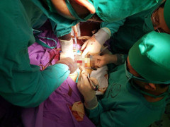 Nghĩ đau ruột thừa, nhập viện mới biết mắc bệnh nguy hiểm tính mạng