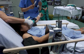 Người phụ nữ vô tình bị cuốn cả bàn tay vào máy xay thịt