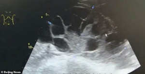 Cô gái 20 tuổi ra chợ đen bán trứng để có tiền mua Iphone