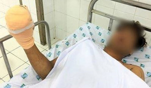 Dùng điện thoại lúc sạc pin, nam thanh niên suýt mất cả bàn tay