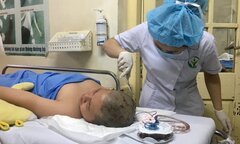 Nam sinh lớp 6 bị cột đỡ sào nhảy cao cắm trúng đầu chuyển lên Bệnh viện Việt Đức